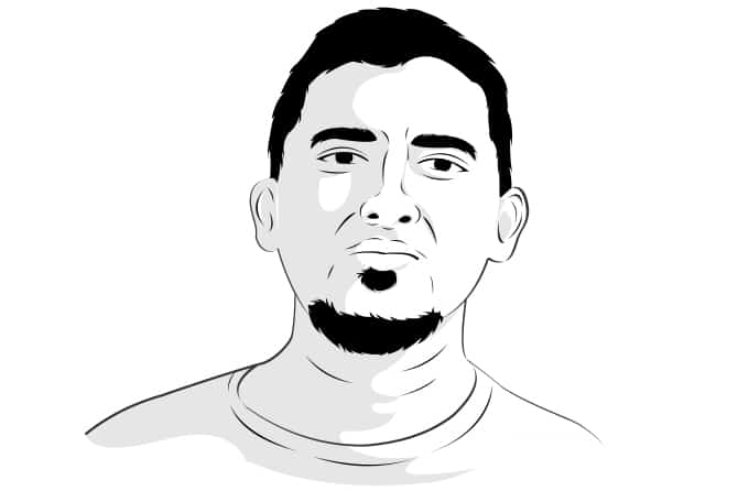 Penanganan Varises Kala Pandemi
